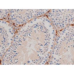 Invitrogen Phospho-Cdc25A (Ser124) Polyclonal Antibody 100 &mu;L; Unconjugated:Antibodies,