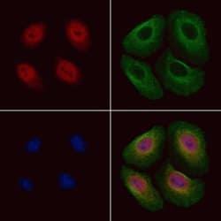 Invitrogen Phospho-SREBP1 (Ser439) Polyclonal Antibody 100 &mu;L; Unconjugated:Antibodies,