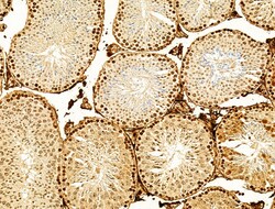 Invitrogen Phospho-SREBP1 (Ser439) Polyclonal Antibody 100 &mu;L; Unconjugated:Antibodies,