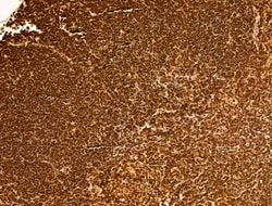 Invitrogen Phospho-SREBP1 (Ser439) Polyclonal Antibody 100 &mu;L; Unconjugated:Antibodies,
