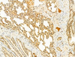 Invitrogen Phospho-SREBP1 (Ser439) Polyclonal Antibody 100 &mu;L; Unconjugated:Antibodies,