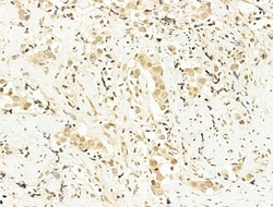 Invitrogen Phospho-SREBP1 (Ser439) Polyclonal Antibody 100 &mu;L; Unconjugated:Antibodies,