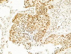 Invitrogen Phospho-SREBP1 (Ser439) Polyclonal Antibody 100 &mu;L; Unconjugated:Antibodies,