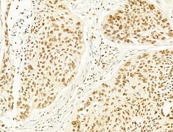 Invitrogen Phospho-SREBP1 (Ser439) Polyclonal Antibody 100 &mu;L; Unconjugated:Antibodies,