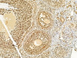 Invitrogen Phospho-SREBP1 (Ser439) Polyclonal Antibody 100 &mu;L; Unconjugated:Antibodies,