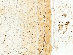 Invitrogen Phospho-SREBP1 (Ser439) Polyclonal Antibody 100 &mu;L; Unconjugated:Antibodies,