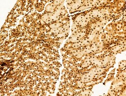 Invitrogen Phospho-SREBP1 (Ser439) Polyclonal Antibody 100 &mu;L; Unconjugated:Antibodies,