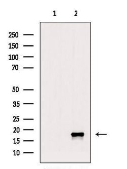 Invitrogen Phospho-Alpha-synuclein (Tyr136) Polyclonal Antibody 100 &mu;L;
