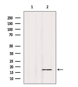 Invitrogen Phospho-Alpha-synuclein (Tyr136) Polyclonal Antibody 100 &mu;L;