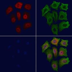 Invitrogen Phospho-p21 (Thr145) Polyclonal Antibody 100 &mu;L; Unconjugated:Antibodies,