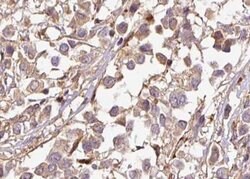 Invitrogen Phospho-p21 (Thr145) Polyclonal Antibody 100 &mu;L; Unconjugated:Antibodies,