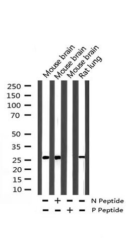 Invitrogen Phospho-p21 (Thr145) Polyclonal Antibody 100 &mu;L; Unconjugated:Antibodies,