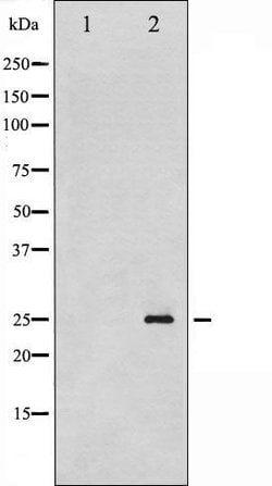 Invitrogen Phospho-p21 (Thr145) Polyclonal Antibody 100 &mu;L; Unconjugated:Antibodies,