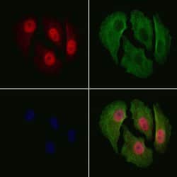 Invitrogen Phospho-p27 Kip1 (Thr198) Polyclonal Antibody 100 &mu;L; Unconjugated:Antibodies,