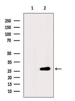 Invitrogen Phospho-p27 Kip1 (Thr198) Polyclonal Antibody 100 &mu;L; Unconjugated:Antibodies,