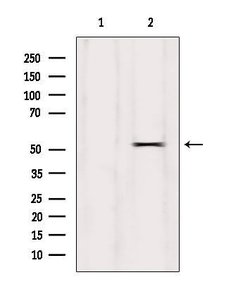 Invitrogen Phospho-GSK3 alpha (Ser21) Polyclonal Antibody 100 &mu;L | Buy Online | Invitrogen&trade; | Fisher Scientific