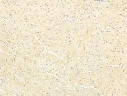 Invitrogen Phospho-SMAD2/SMAD3 (Thr8) Polyclonal Antibody 100 &mu;L; Unconjugated:Antibodies,