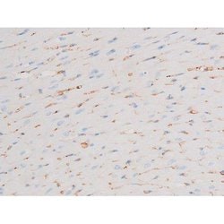 Invitrogen Phospho-PKC theta (Ser676) Polyclonal Antibody 100 &mu;L | Buy Online | Invitrogen&trade; | Fisher Scientific