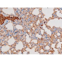 Invitrogen Phospho-PKC theta (Ser676) Polyclonal Antibody 100 &mu;L | Buy Online | Invitrogen&trade; | Fisher Scientific