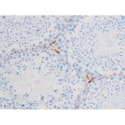 Invitrogen Phospho-PKC theta (Ser676) Polyclonal Antibody 100 &mu;L | Buy Online | Invitrogen&trade; | Fisher Scientific