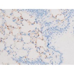 Invitrogen Phospho-PKC theta (Ser676) Polyclonal Antibody 100 &mu;L | Buy Online | Invitrogen&trade; | Fisher Scientific