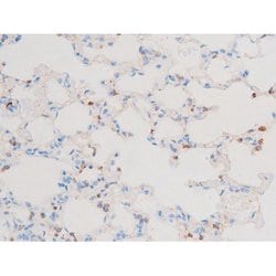 Invitrogen Phospho-PKC theta (Ser676) Polyclonal Antibody 100 &mu;L | Buy Online | Invitrogen&trade; | Fisher Scientific