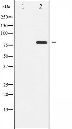Invitrogen Phospho-PKC theta (Ser676) Polyclonal Antibody 100 &mu;L | Buy Online | Invitrogen&trade; | Fisher Scientific