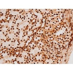 Invitrogen Phospho-C-rel (Ser503) Polyclonal Antibody 100 &mu;L; Unconjugated:Antibodies,