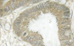 Invitrogen Phospho-HSL (Ser855, Ser554) Polyclonal Antibody 100 &mu;L;