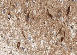 Invitrogen Phospho-HSL (Ser552) Polyclonal Antibody 100 &mu;L | Buy Online | Invitrogen&trade; | Fisher Scientific