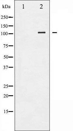 Invitrogen Phospho-HSL (Ser552) Polyclonal Antibody 100 &mu;L | Buy Online | Invitrogen&trade; | Fisher Scientific