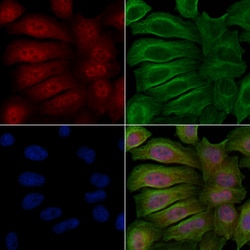 Invitrogen Phospho-PKC delta (Ser645) Polyclonal Antibody 100 &mu;L | Buy Online | Invitrogen&trade; | Fisher Scientific