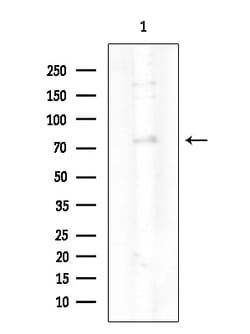 Invitrogen Phospho-PKC delta (Ser645) Polyclonal Antibody 100 &mu;L | Buy Online | Invitrogen&trade; | Fisher Scientific