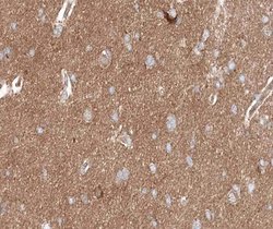 Invitrogen Phospho-PKC delta (Ser645) Polyclonal Antibody 100 &mu;L | Buy Online | Invitrogen&trade; | Fisher Scientific