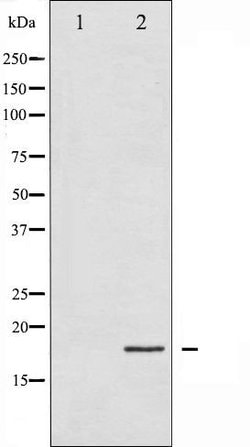 Invitrogen Phospho-4EBP1 (Thr45) Polyclonal Antibody 100 &mu;L | Buy Online | Invitrogen&trade; | Fisher Scientific