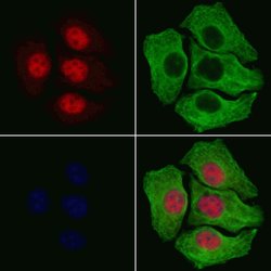 Phospho-IkappaB beta (Ser19) Polyclonal Antibody, Invitrogen 100 μL;