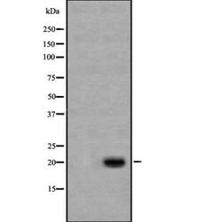 Invitrogen Caspase 1 p20 (Cleaved Asp296) Polyclonal Antibody 100 &mu;L;