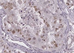 Invitrogen TWIST2 Polyclonal Antibody 100 &mu;L; Unconjugated:Antibodies,