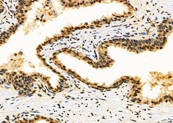Invitrogen TWIST2 Polyclonal Antibody 100 &mu;L; Unconjugated:Antibodies,