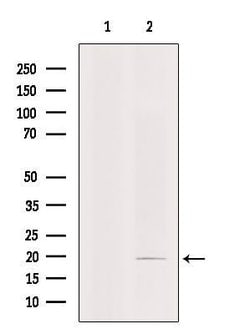Invitrogen TWIST2 Polyclonal Antibody 100 &mu;L; Unconjugated:Antibodies,