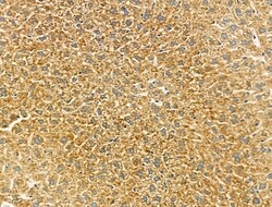 Invitrogen&trade;&nbsp;Connexin 45 Polyclonal Antibody