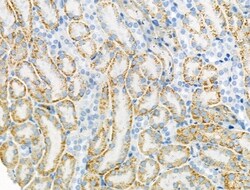 Invitrogen&trade;&nbsp;Connexin 45 Polyclonal Antibody