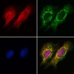 PIK3CA Polyclonal Antibody:Antibodies, Polyclonal