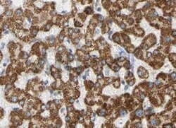 PIK3CA Polyclonal Antibody:Antibodies, Polyclonal