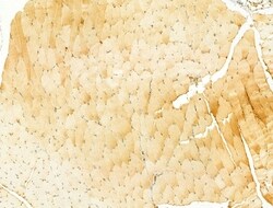 PIK3CA Polyclonal Antibody:Antibodies, Polyclonal