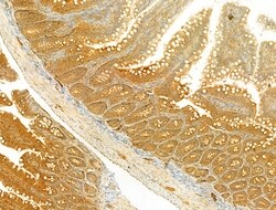 PIK3CA Polyclonal Antibody:Antibodies, Polyclonal