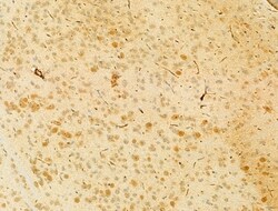 PIK3CA Polyclonal Antibody:Antibodies, Polyclonal