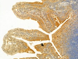 PIK3CA Polyclonal Antibody:Antibodies, Polyclonal