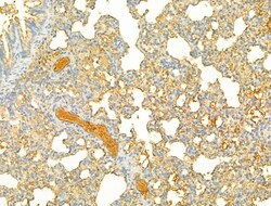 PIK3CA Polyclonal Antibody:Antibodies, Polyclonal