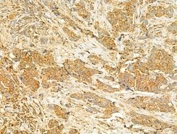 PIK3CA Polyclonal Antibody:Antibodies, Polyclonal